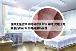 皮康王是激素藥嗎可以長(zhǎng)時(shí)間用嗎 皮康王是激素藥嗎可以長(zhǎng)時(shí)間用嗎女性
