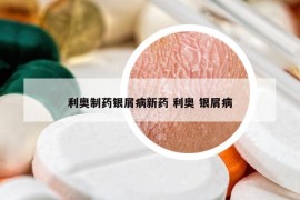 利奧制藥銀屑病新藥 利奧 銀屑病