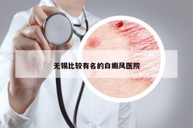 無(wú)錫比較有名的白癜風(fēng)醫(yī)院