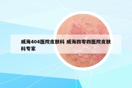 威海404醫(yī)院皮膚科 威海四零四醫(yī)院皮膚科專家