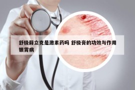 舒極蘚立克是激素藥嗎 舒極膏的功效與作用銀霄病