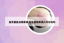 益生菌能治銀屑病 益生菌銀屑病人可以吃嗎