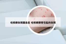 吃檳榔白斑圖自愈 吃檳榔摩擦引起的白斑