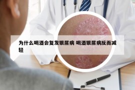 為什么喝酒會(huì)復(fù)發(fā)銀屑病 喝酒銀屑病反而減輕