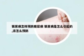 銀屑病怎樣預(yù)防糖尿病 銀屑病是怎么引起的,該怎么預(yù)防