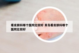 看皮膚科哪個醫(yī)院比較好 青島看皮膚科哪個醫(yī)院比較好