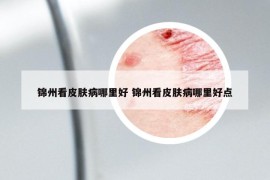 錦州看皮膚病哪里好 錦州看皮膚病哪里好點(diǎn)