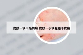 皮膚一塊干燥的癬 皮膚一小塊粗糙干皮癬