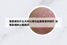 銀屑病為什么大夫讓我吃鹽酸西替利嗪片 治銀屑病的口服西藥