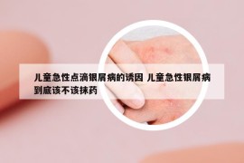 兒童急性點(diǎn)滴銀屑病的誘因 兒童急性銀屑病到底該不該抹藥