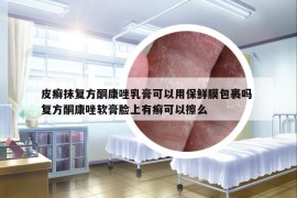 皮癬抹復(fù)方酮康唑乳膏可以用保鮮膜包裹嗎 復(fù)方酮康唑軟膏臉上有癬可以擦么