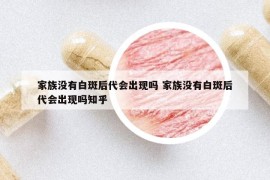 家族沒有白斑后代會出現(xiàn)嗎 家族沒有白斑后代會出現(xiàn)嗎知乎