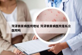 菏澤銀屑病醫(yī)院地址 菏澤銀屑病醫(yī)院是私立醫(yī)院嗎