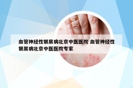 血管神經(jīng)性銀屑病北京中醫(yī)醫(yī)院 血管神經(jīng)性銀屑病北京中醫(yī)醫(yī)院專家