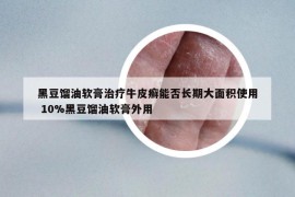 黑豆餾油軟膏治療牛皮癬能否長期大面積使用 10%黑豆餾油軟膏外用