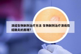 潰結生物制劑治療方法 生物制劑治療潰瘍性結腸炎的原理?