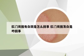 肛門周圍有白斑是怎么回事 肛門周圍發(fā)白是咋回事