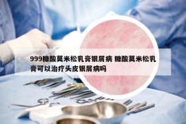 999糠酸莫米松乳膏銀屑病 糠酸莫米松乳膏可以治療頭皮銀屑病嗎