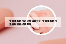 中國(guó)哪家醫(yī)院治皮膚病最好的 中國(guó)哪家醫(yī)院治皮膚病最好的專家