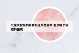北京有權(quán)威的皮膚科醫(yī)院是哪家 北京哪個(gè)皮膚科醫(yī)院