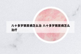 八十多歲銀屑病怎么治 八十多歲銀屑病怎么治療