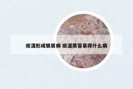 痰濕形成銀屑病 痰濕質(zhì)容易得什么病