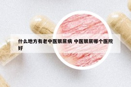 什么地方有老中醫(yī)銀屑病 中醫(yī)銀屑哪個醫(yī)院好