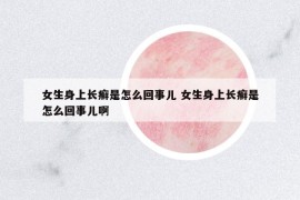 女生身上長(zhǎng)癬是怎么回事兒 女生身上長(zhǎng)癬是怎么回事兒啊