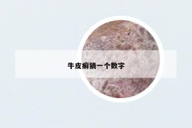 牛皮癬猜一個數(shù)字