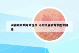 河南銀屑病專家醫(yī)生 河南銀屑病專家醫(yī)生排名