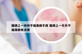 胳膊上一塊塊干燥像癬不癢 胳膊上一片片干燥像癬有點癢