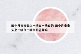 四個月寶寶頭上一塊白一塊白的 四個月寶寶頭上一塊白一塊白的正常嗎