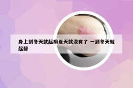 身上到冬天就起癬夏天就沒有了 一到冬天就起蘚