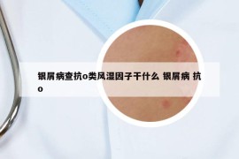 銀屑病查抗o類風(fēng)濕因子干什么 銀屑病 抗o