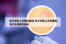 青少年臉上長癬的原因 青少年臉上長斑是因為什么原因引起的