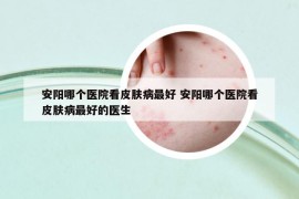 安陽(yáng)哪個(gè)醫(yī)院看皮膚病最好 安陽(yáng)哪個(gè)醫(yī)院看皮膚病最好的醫(yī)生