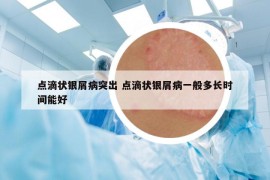 點滴狀銀屑病突出 點滴狀銀屑病一般多長時間能好
