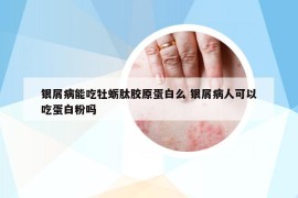 銀屑病能吃牡蠣肽膠原蛋白么 銀屑病人可以吃蛋白粉嗎