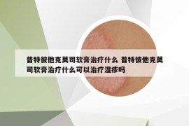 普特彼他克莫司軟膏治療什么 普特彼他克莫司軟膏治療什么可以治療濕疹嗎