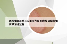 斑塊狀銀屑病與心里壓力有關(guān)系嗎 斑塊型銀屑病消退過(guò)程