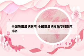 全國暑銀屑病醫(yī)院 全國銀屑病皮膚?？漆t(yī)院排名