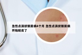 急性點滴狀銀屑病4個月 急性點滴狀銀屑病開始蛻皮了