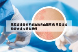 黑豆餾油膏能不能治流鼻血銀屑病 黑豆餾油軟膏會讓皮膚變黑嗎