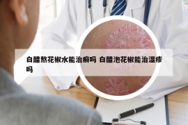 白醋熬花椒水能治癬嗎 白醋泡花椒能治濕疹嗎