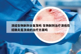 潰結生物制劑會復發(fā)嗎 生物制劑治療潰瘍性結腸炎是頂級的治療方案嗎