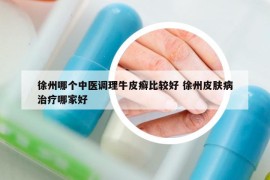 徐州哪個(gè)中醫(yī)調(diào)理牛皮癬比較好 徐州皮膚病治療哪家好