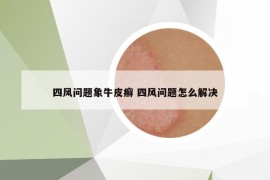 四風(fēng)問(wèn)題象牛皮癬 四風(fēng)問(wèn)題怎么解決