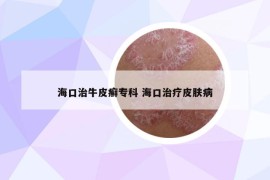 海口治牛皮癬?？?海口治療皮膚病
