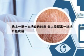 頭上一摳一大塊白色的皮 頭上能摳出一塊塊白色皮屑