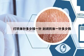 打抗體針多少錢一針 封閉抗體一針多少錢